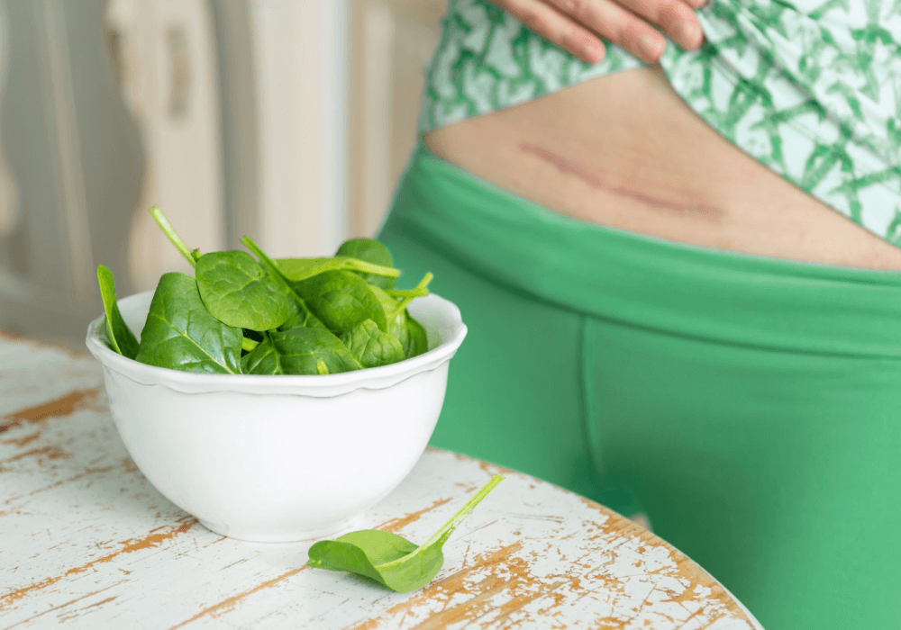 تغذیه بعد از سزارین