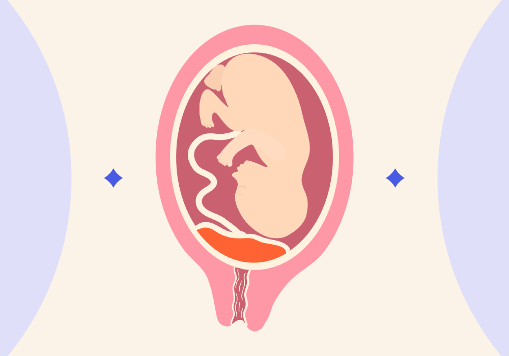 جدا شدن جفت از جنین