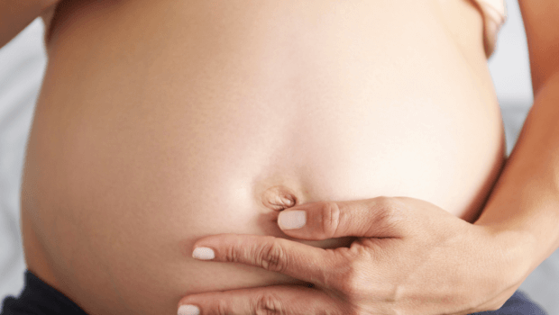 پیشگیری از داخل رفتن ناف در بارداری