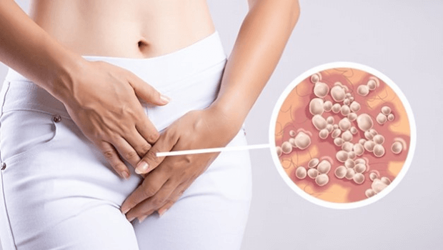 راه های انتقال تبخال تناسلی