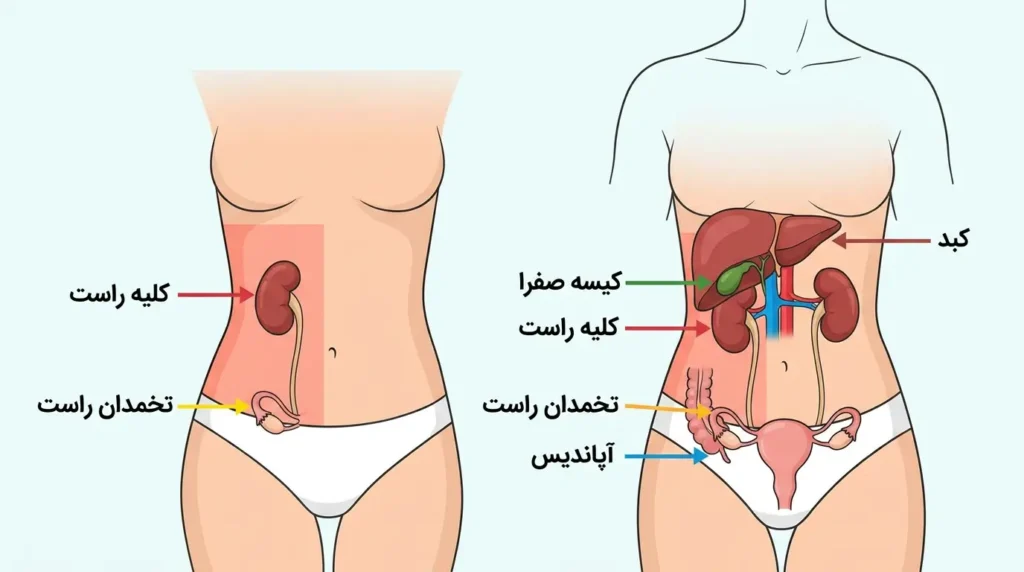 اینفوگرافیک فارسی اندام‌های مرتبط با درد پهلوی راست در زنان شامل کلیه تخمدان آپاندیس کیسه صفرا