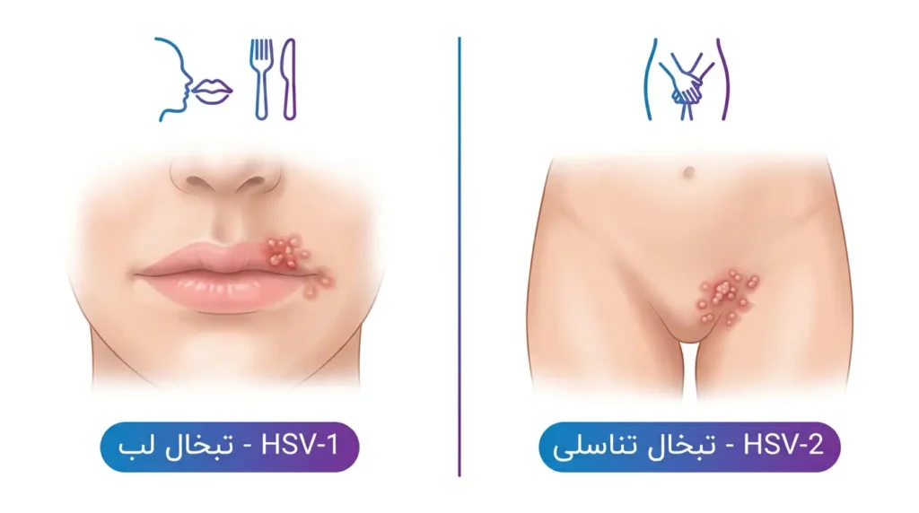 اینفوگرافیک تفاوت HSV-1 و HSV-2 - تبخال لب و تبخال تناسلی 